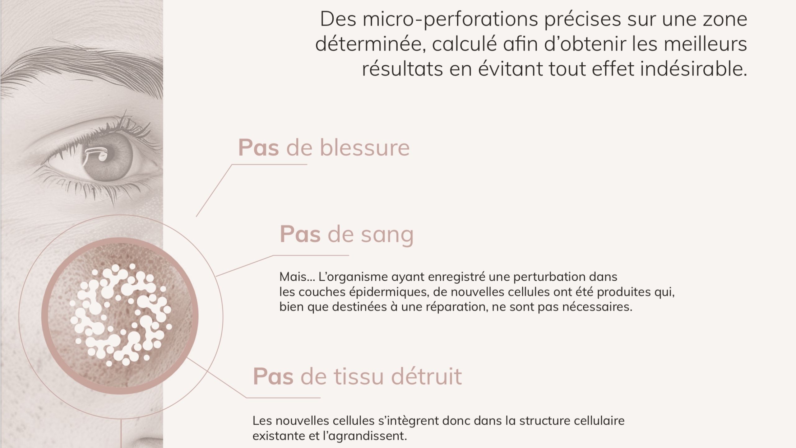 ACS Pen micro aiguilles Colomiers Toulouse